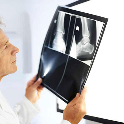  X Ray 