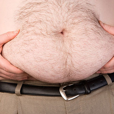  Obese 