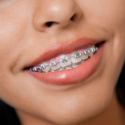 Orthodontics