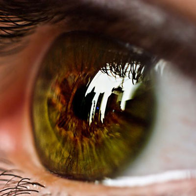 Auge