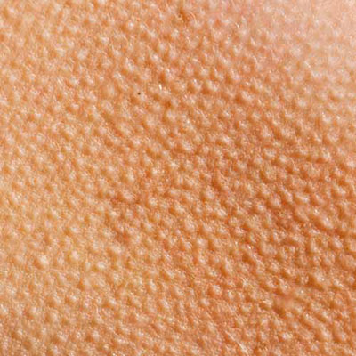  Goose Bumps 