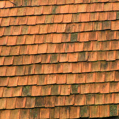 Shingles