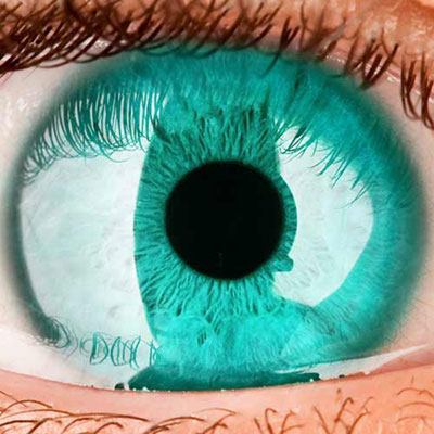  Iris 