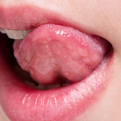 Tongue