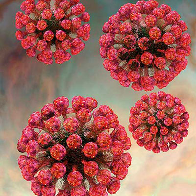Rubella
