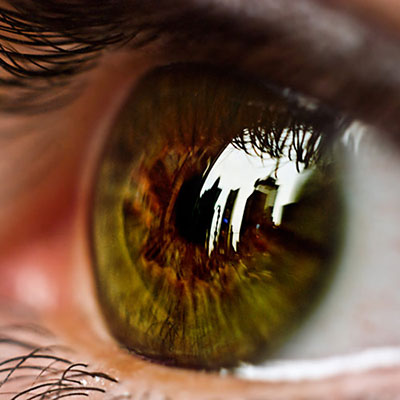 Vision
