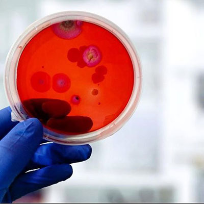 Petri Dish