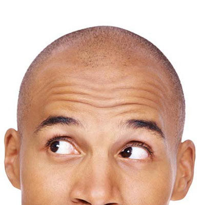 Bald