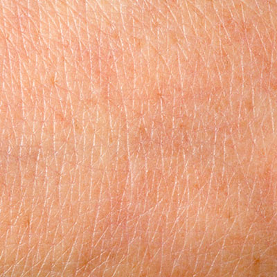  Epidermis 