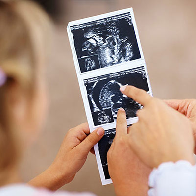 Sonogram