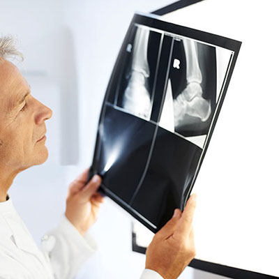 X-ray