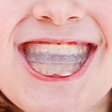  Mouthguard 