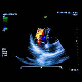 Ultrasound 