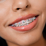  Orthodontics 