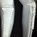 Titanium 