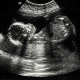  Ultrasound 