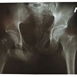  X Ray 