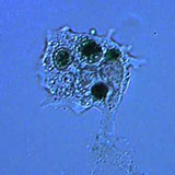  Amoeba 