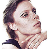  Freckles 