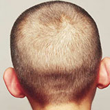  Buzzcut 