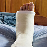  Plaster Cast 