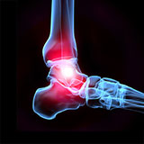  Ankle 