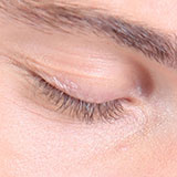  Eyelid 