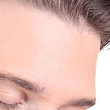  Forehead 
