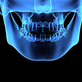  Jaw 