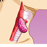  Throat 