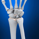  Ulna 