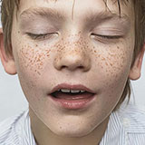  Freckles 