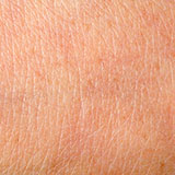  Epidermis 